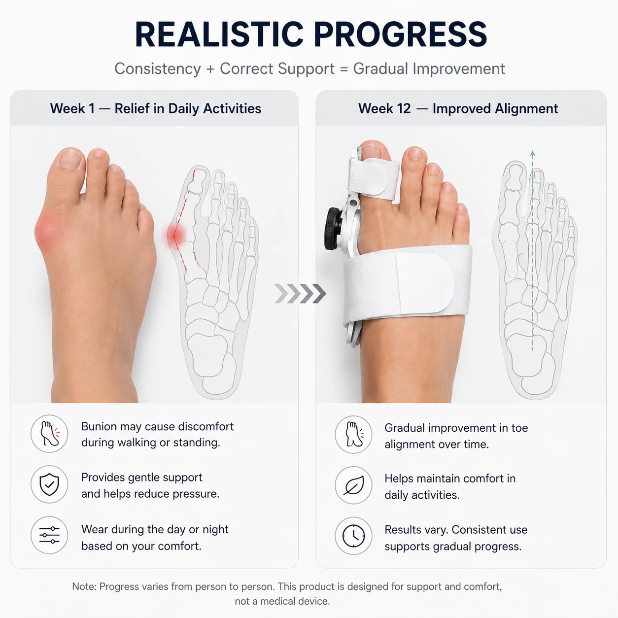 Week by week alignment progress with the ReAlign corrector